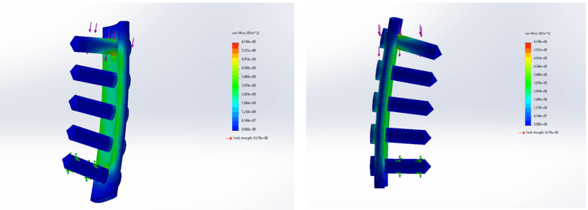Femur Plate Implant Design